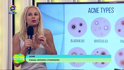 MA ACNE STVPLAY 12 10 2019